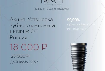Установка зубного импланта Lenmiriot